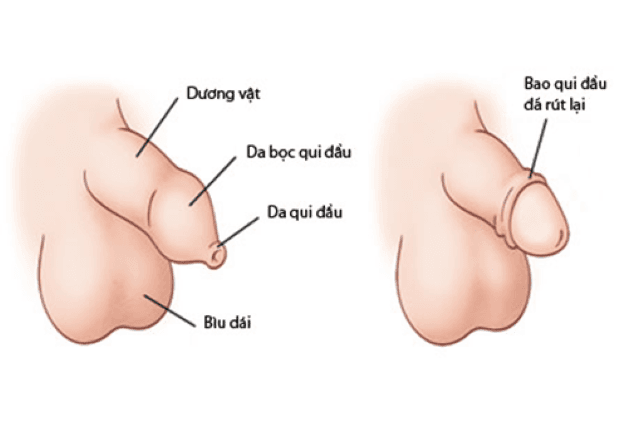 Phần đầu dương vật